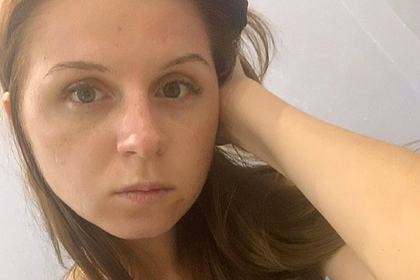 Российскую теннисистку покусали бродячие подмосковные собаки